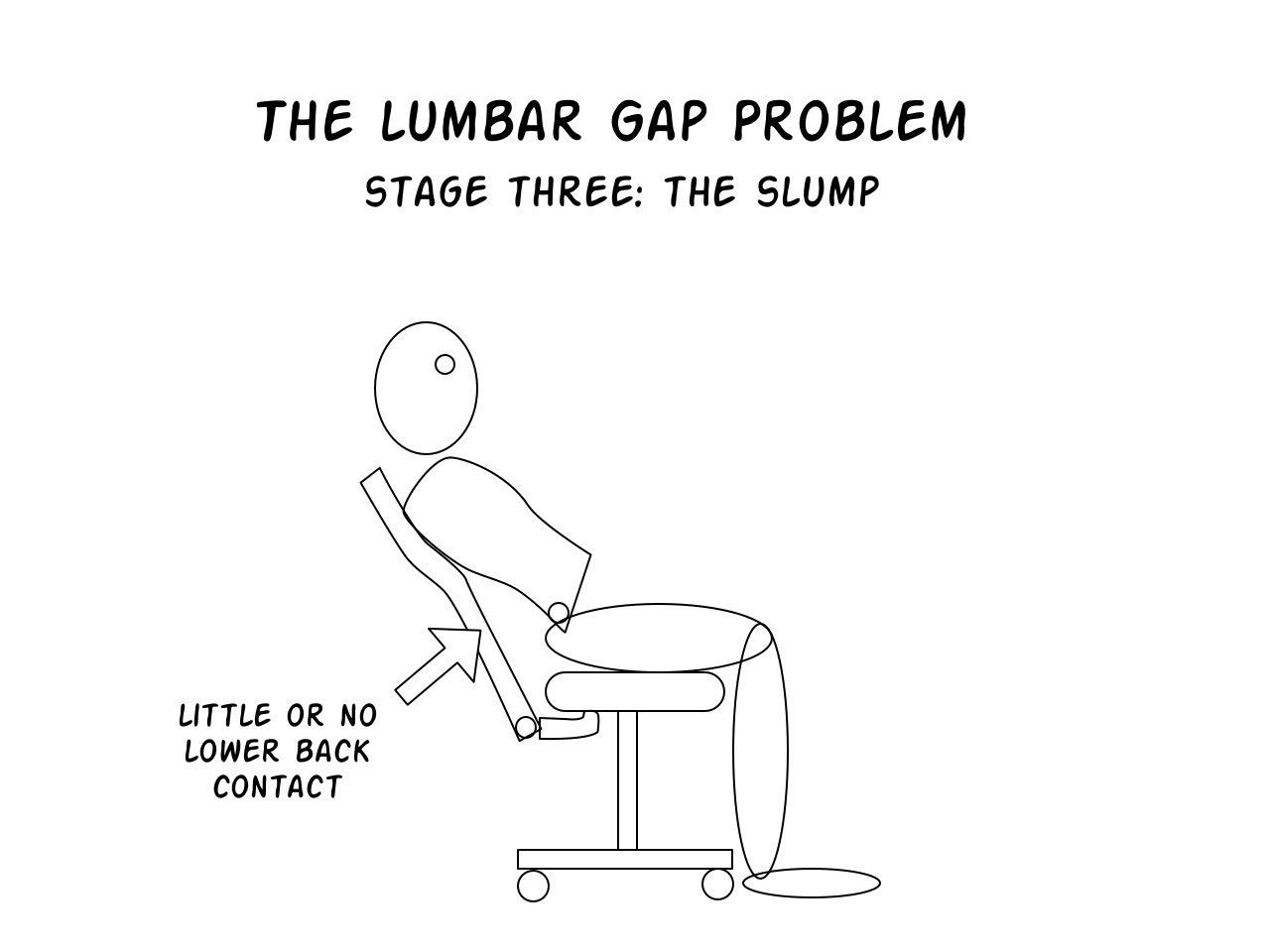 Lumbar Gap Problem stage 3